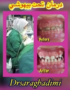درمان دندانپزشکی تحت بیهوشی